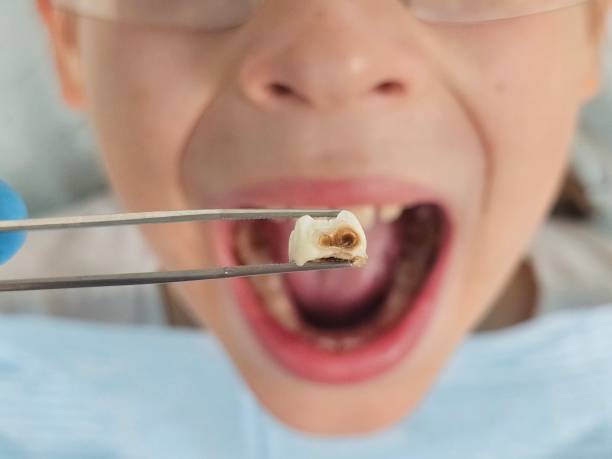 Best Knocked-Out Tooth Emergency  in Tempe, AZ
